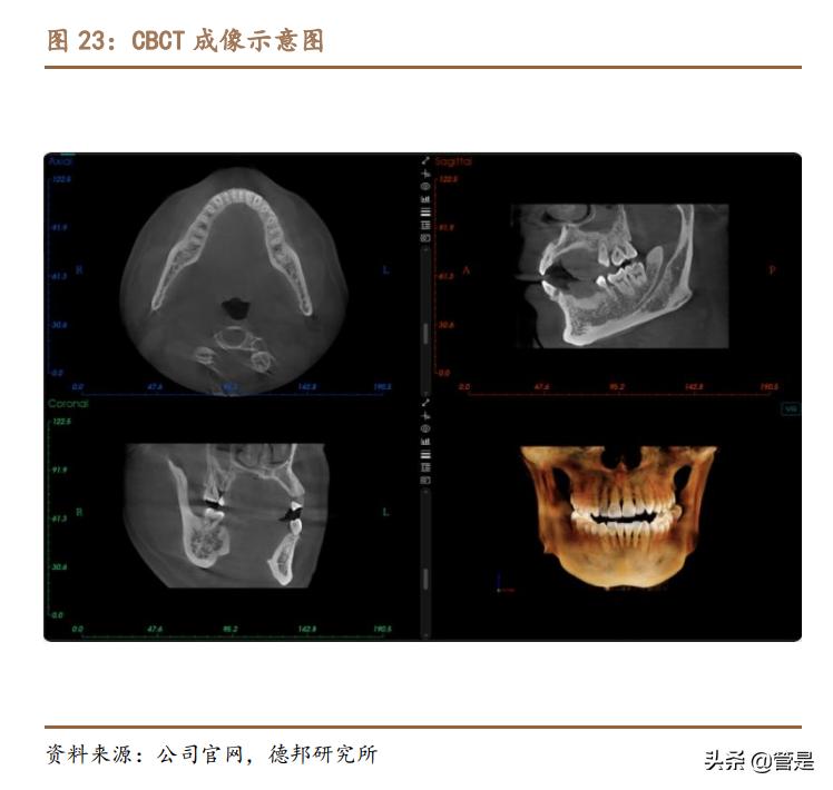 ??美亞光電最新動態??