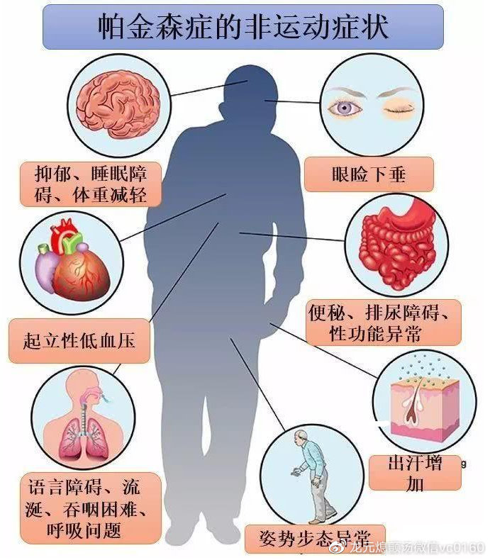 帕金森病最新治療方法及其論述